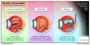 Source: ophthalmology notes and synopses