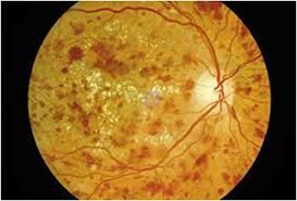 Source: Eye care surgery centre