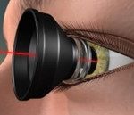 Source: Retina and virteous of San antonio
