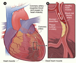 Source: NHLBI