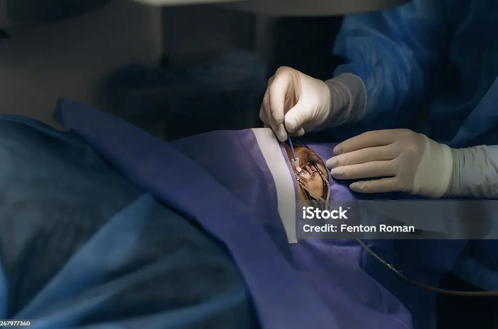 Laser Treatment — clinical photo