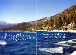 Source: bennent & bloom eye centres