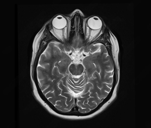Source: Science Photo Library