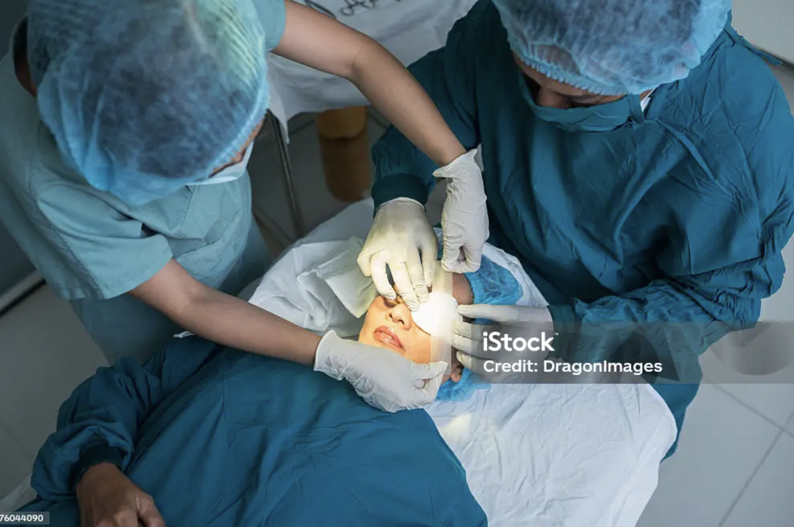 Cataract Surgery — clinical photo