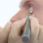 Source:dry eye rescue