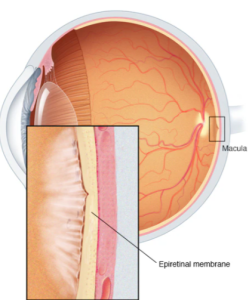 Source: Mayo Clinic